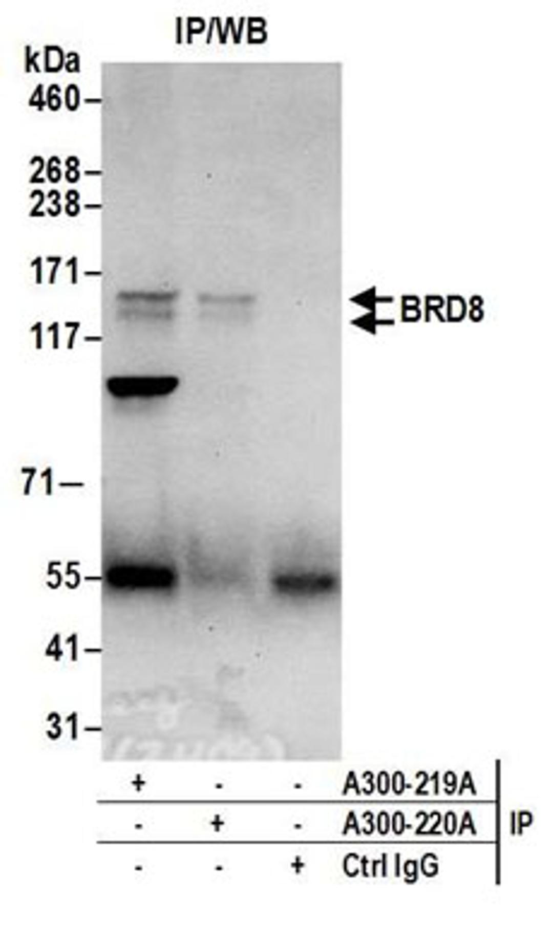 Detection of human BRD8 by western blot of immunoprecipitates.