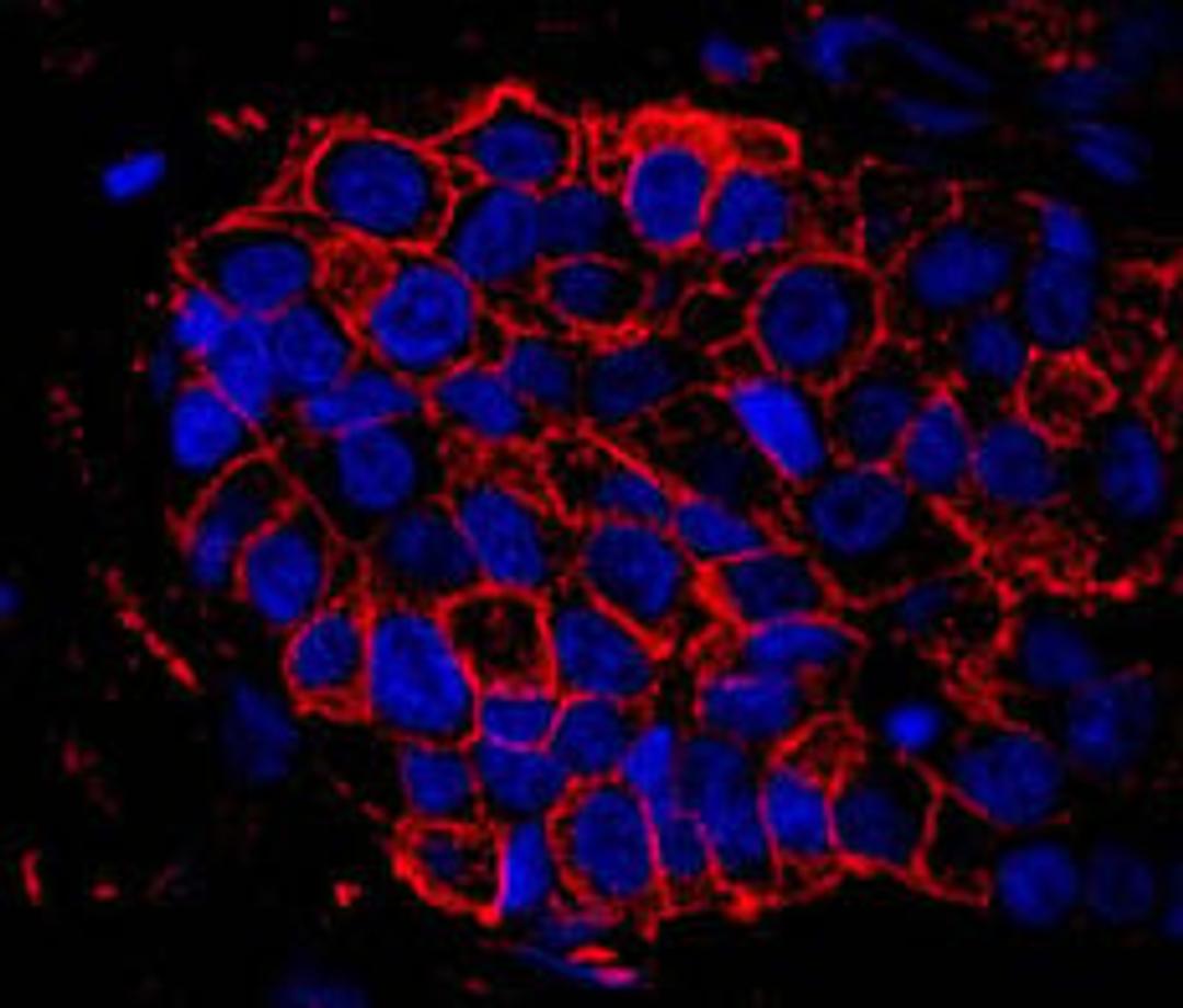 Detection of human IQGAP1 by immunohistochemistry.