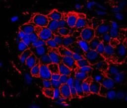 Detection of human IQGAP1 by immunohistochemistry.