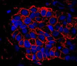 Detection of human IQGAP1 by immunohistochemistry.