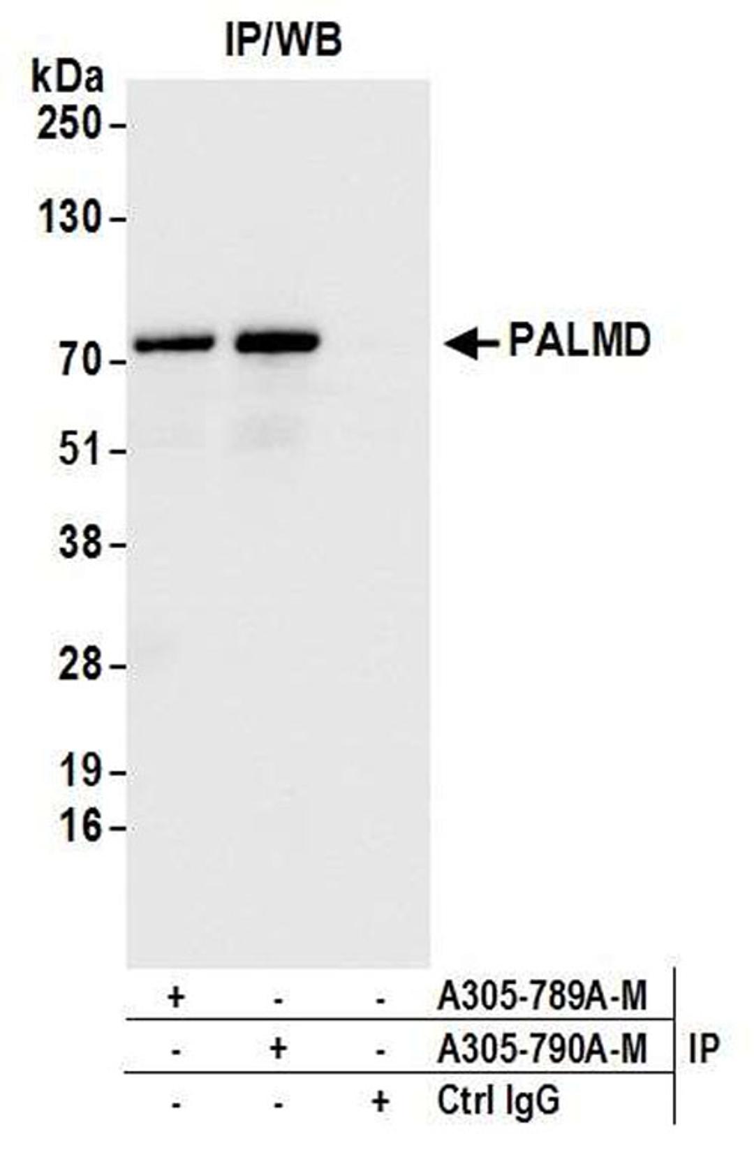 Detection of human PALMD by WB of IP.