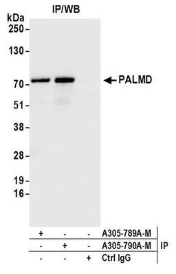 Detection of human PALMD by WB of IP.