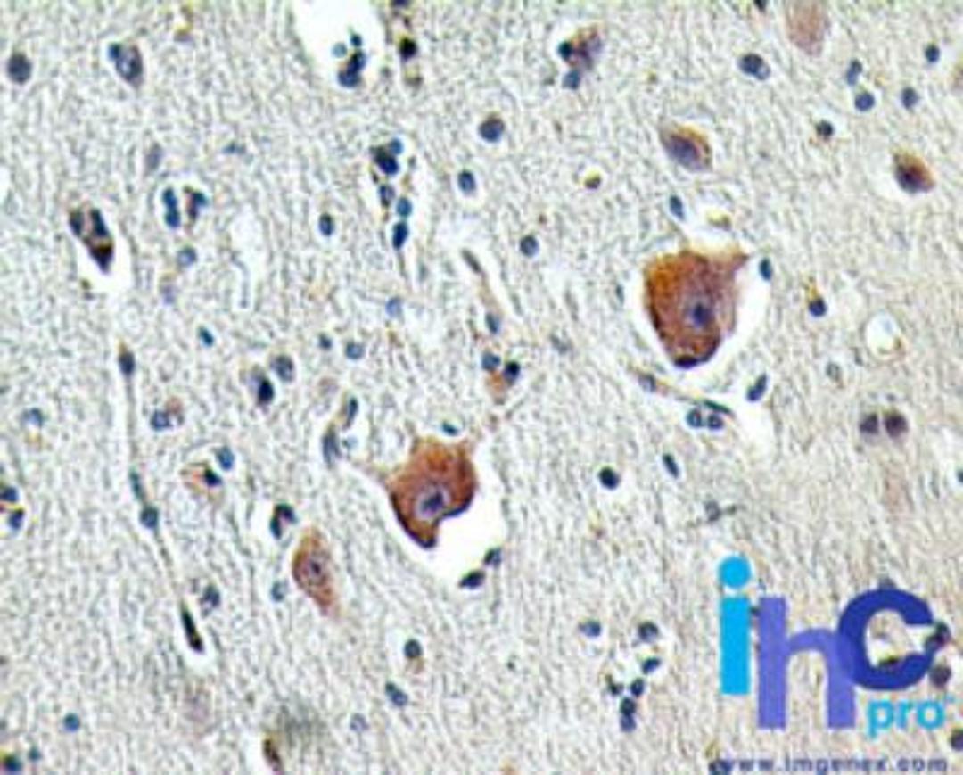 Immunohistochemistry-Paraffin: SHARPIN Antibody [NBP2-27186] - Formalin-fixed, paraffin-embedded human brain stained with Sharpin antibody (5 ug/ml), peroxidase-conjugate and DAB chromogen.