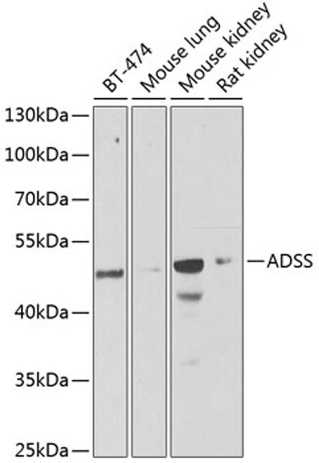 Western blot - ADSS antibody (A6516)