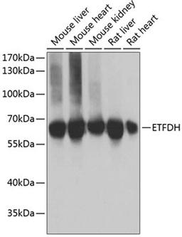 Western blot - ETFDH antibody (A6585)