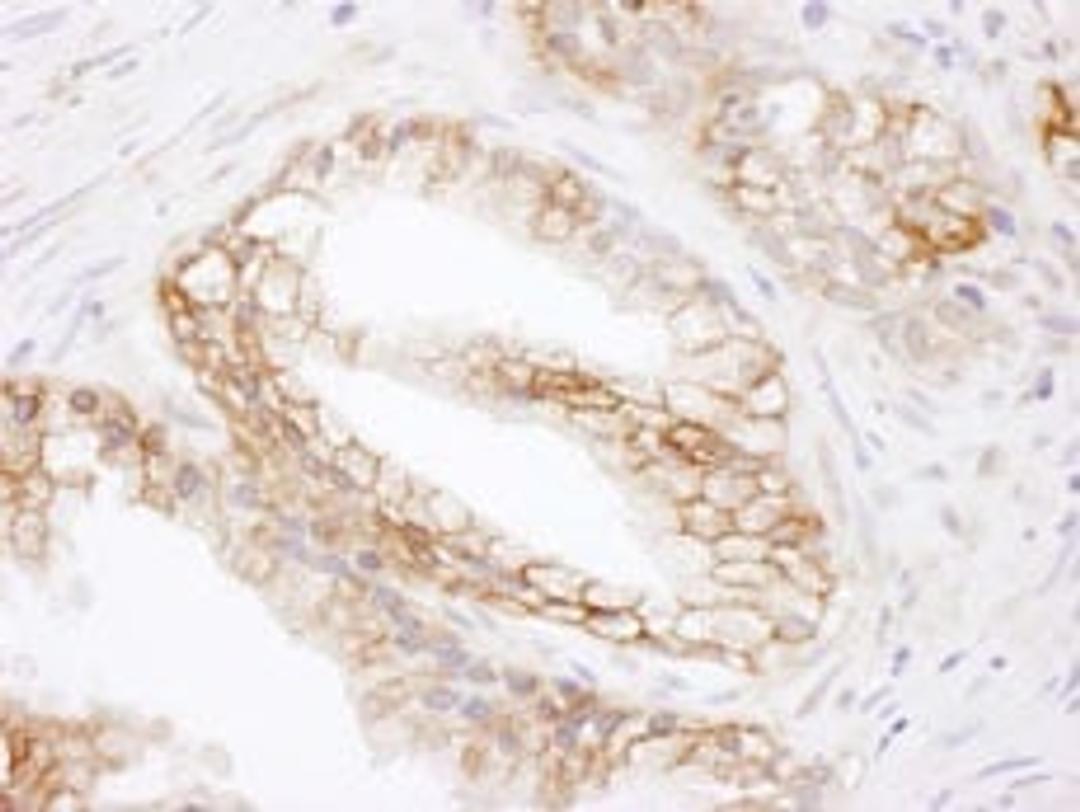 Detection of human MCT1 by immunohistochemistry.