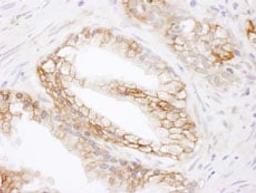 Detection of human MCT1 by immunohistochemistry.