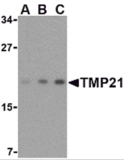 Western blot analysis of TMP21 in mouse brain tissue lysate with TMP21 antibody at (A) 0.5, (B) 1 and (C) 2 &#956;g/mL. 