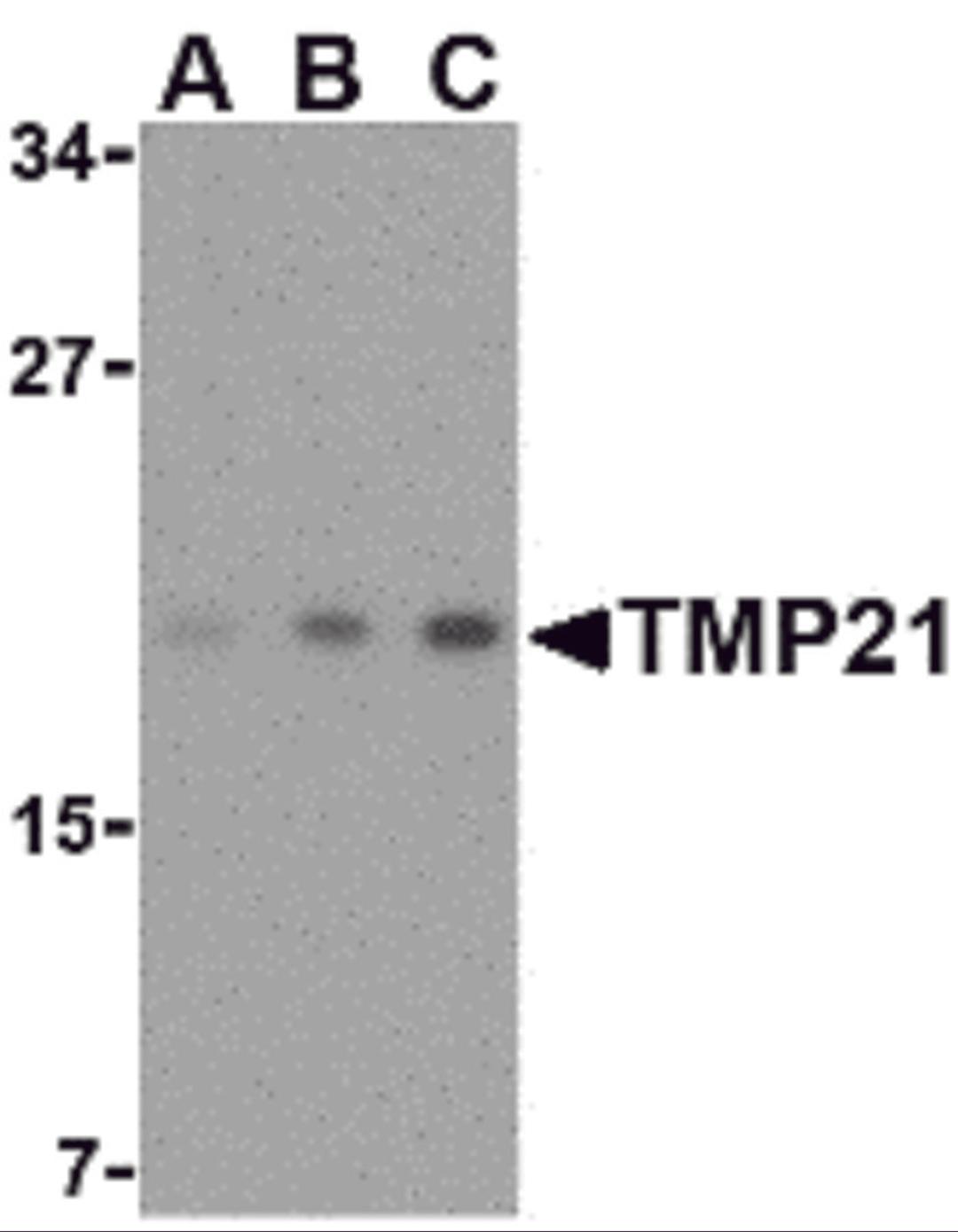 Western blot analysis of TMP21 in mouse brain tissue lysate with TMP21 antibody at (A) 0.5, (B) 1 and (C) 2 μg/mL.