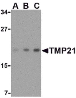 Western blot analysis of TMP21 in mouse brain tissue lysate with TMP21 antibody at (A) 0.5, (B) 1 and (C) 2 μg/mL.