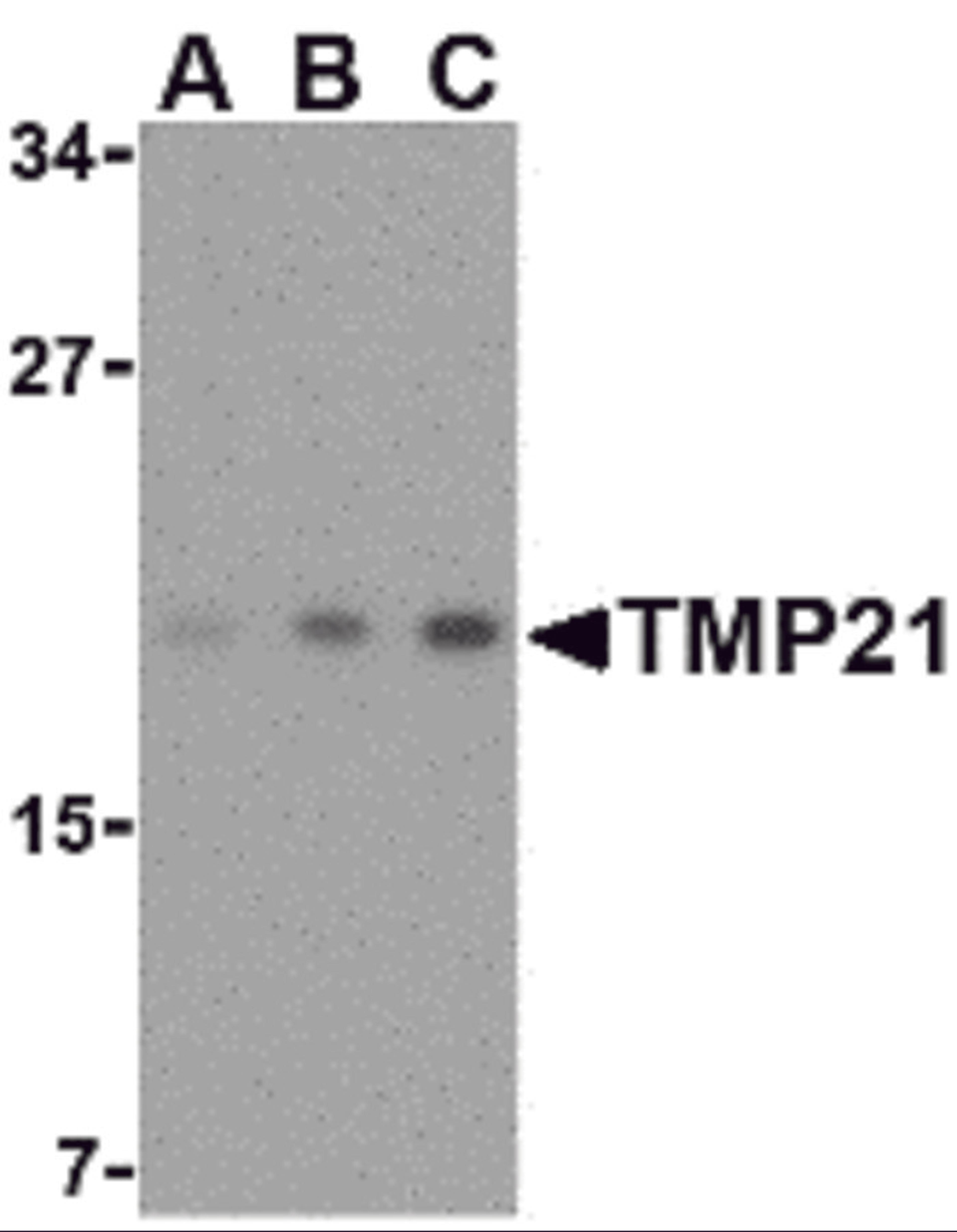 Western blot analysis of TMP21 in mouse brain tissue lysate with TMP21 antibody at (A) 0.5, (B) 1 and (C) 2 μg/mL.