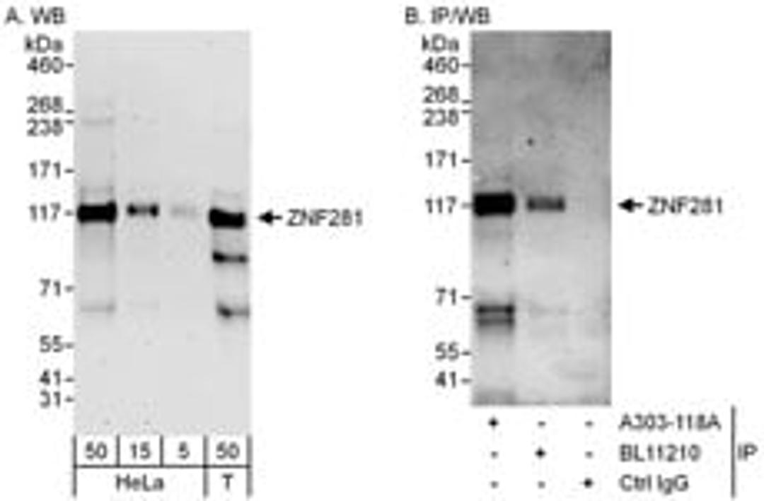 Detection of human ZNF281 by western blot and immunoprecipitation.