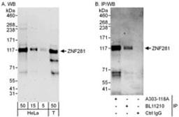 Detection of human ZNF281 by western blot and immunoprecipitation.