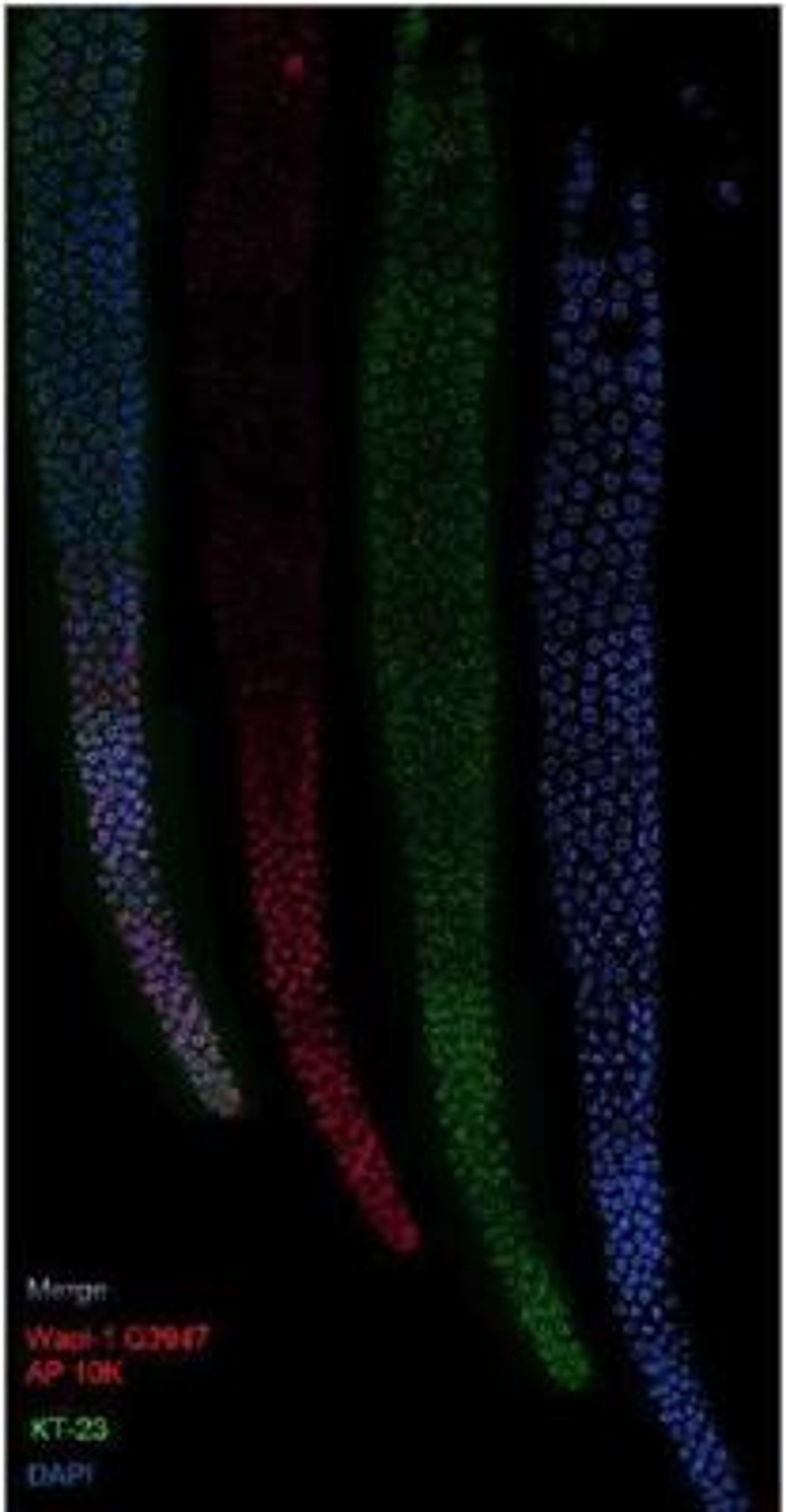 Immunocytochemistry/Immunofluorescence: wapl-1 Antibody [49300002] - This image is specific to animal number SDQ3947  Images are wild type.  Dilution of affinity purified antibody is at 1:10,000.