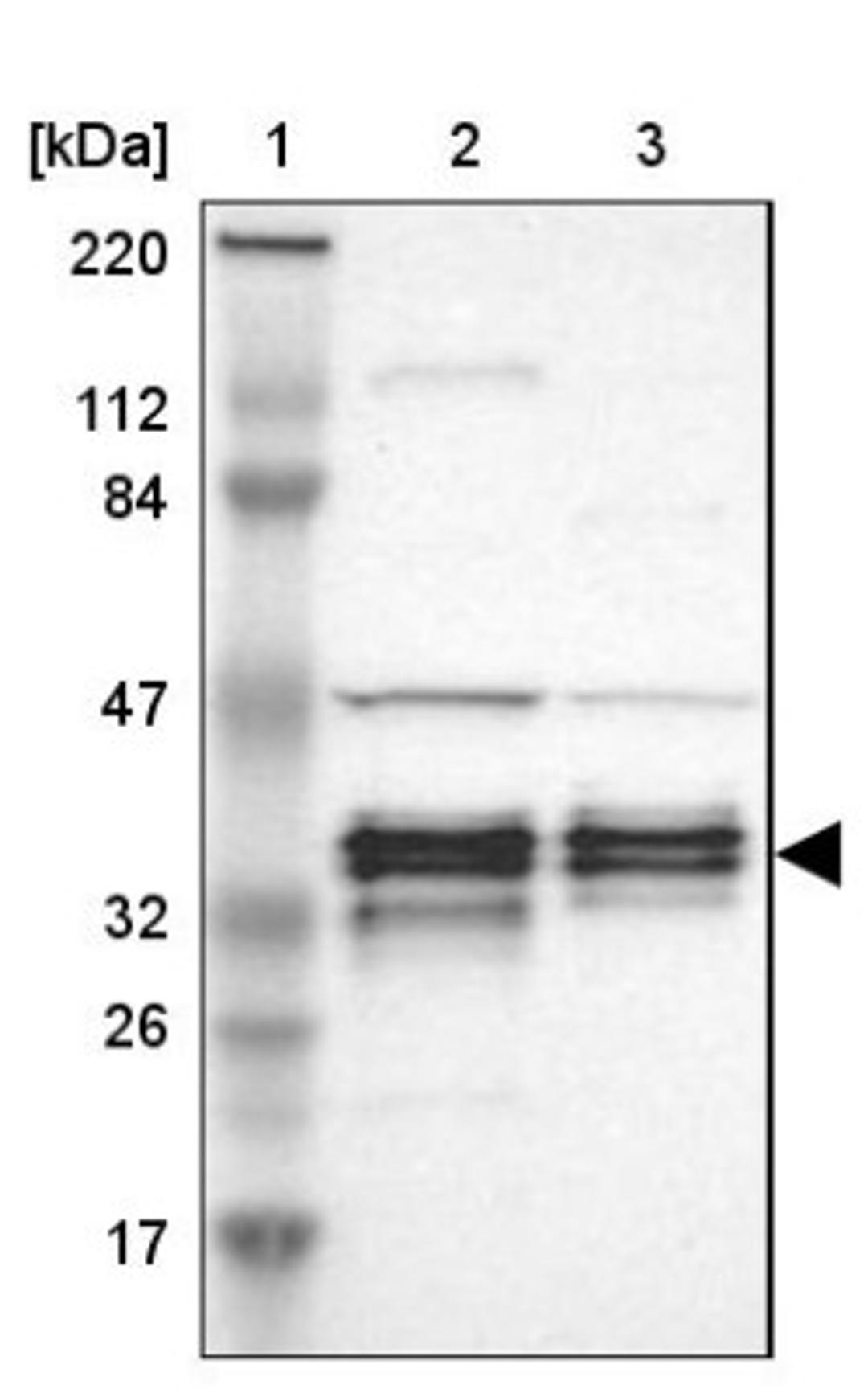 Western Blot: C1orf198 Antibody [NBP1-90519] - Lane 1: Marker [kDa] 220, 112, 84, 47, 32, 26, 17<br/>Lane 2: Human cell line RT-4<br/>Lane 3: Human cell line U-251MG sp