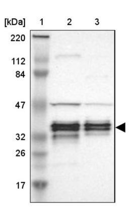 Western Blot: C1orf198 Antibody [NBP1-90519] - Lane 1: Marker [kDa] 220, 112, 84, 47, 32, 26, 17<br/>Lane 2: Human cell line RT-4<br/>Lane 3: Human cell line U-251MG sp