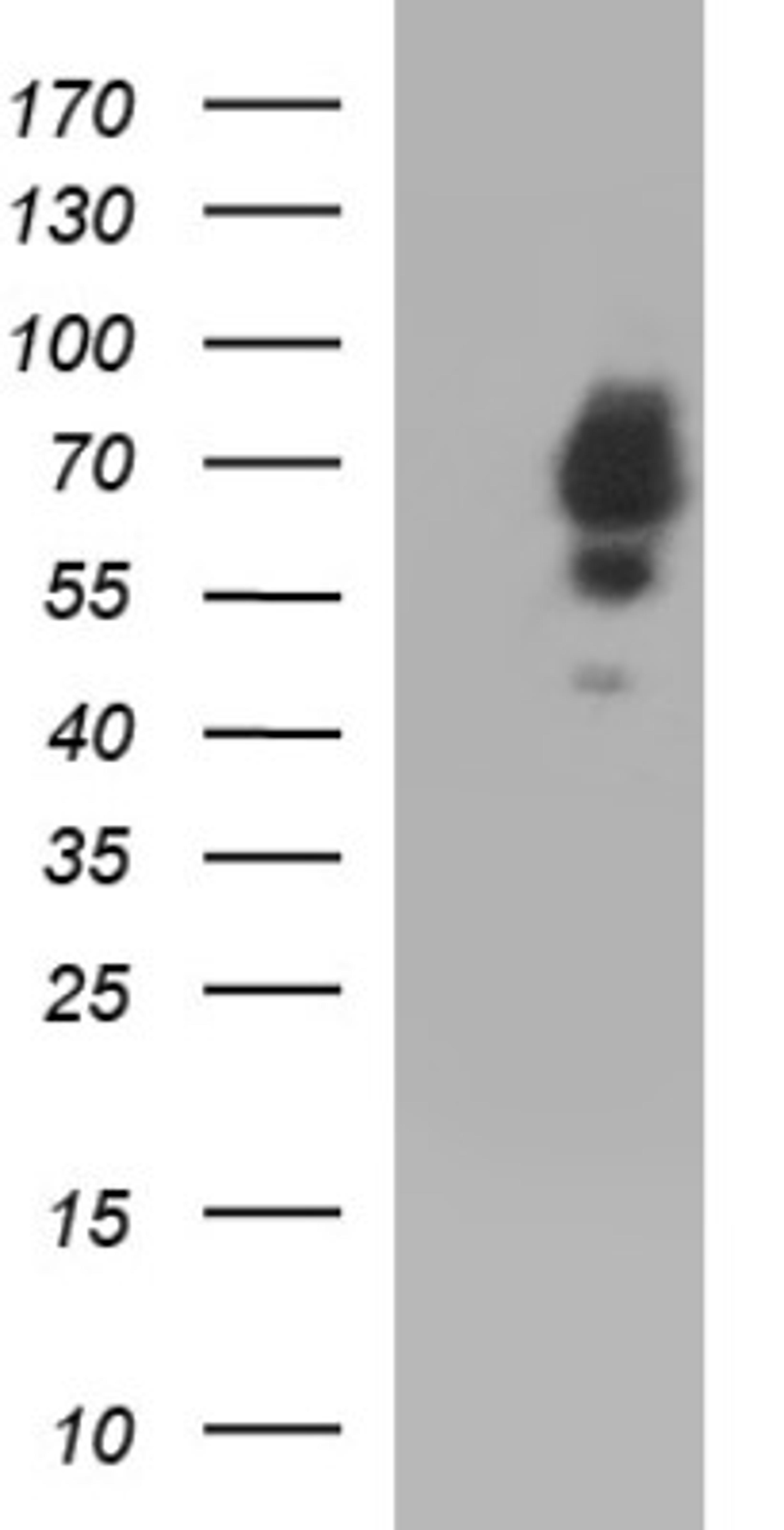 Western Blot: Sterol carrier protein 2 Antibody (1E4) [NBP2-45726] - Analysis of HEK293T cells were transfected with the pCMV6-ENTRY control (Left lane) or pCMV6-ENTRY SCP2.