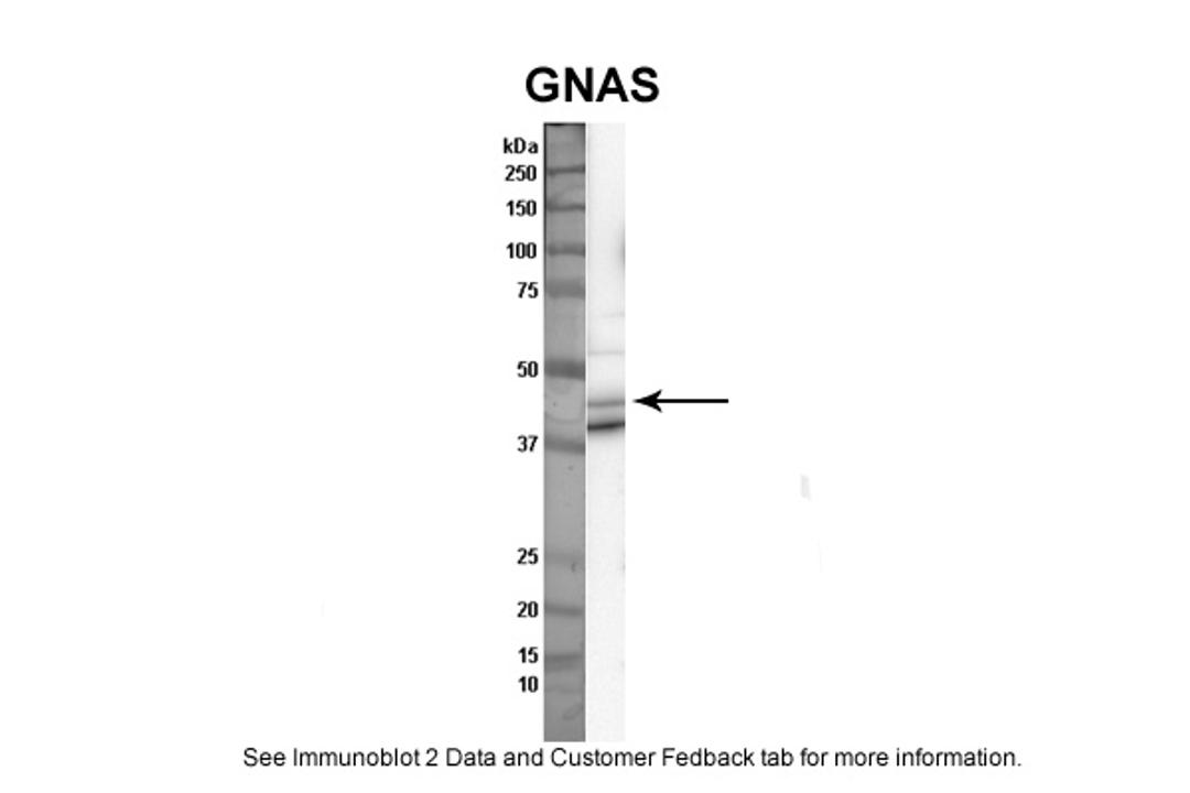 Antibody used in WB on human thryoid at 1:1000.