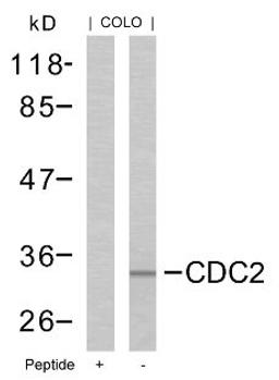 Western blot analysis of lysed extracts from COLO cells using CDC2 (Ab-161).