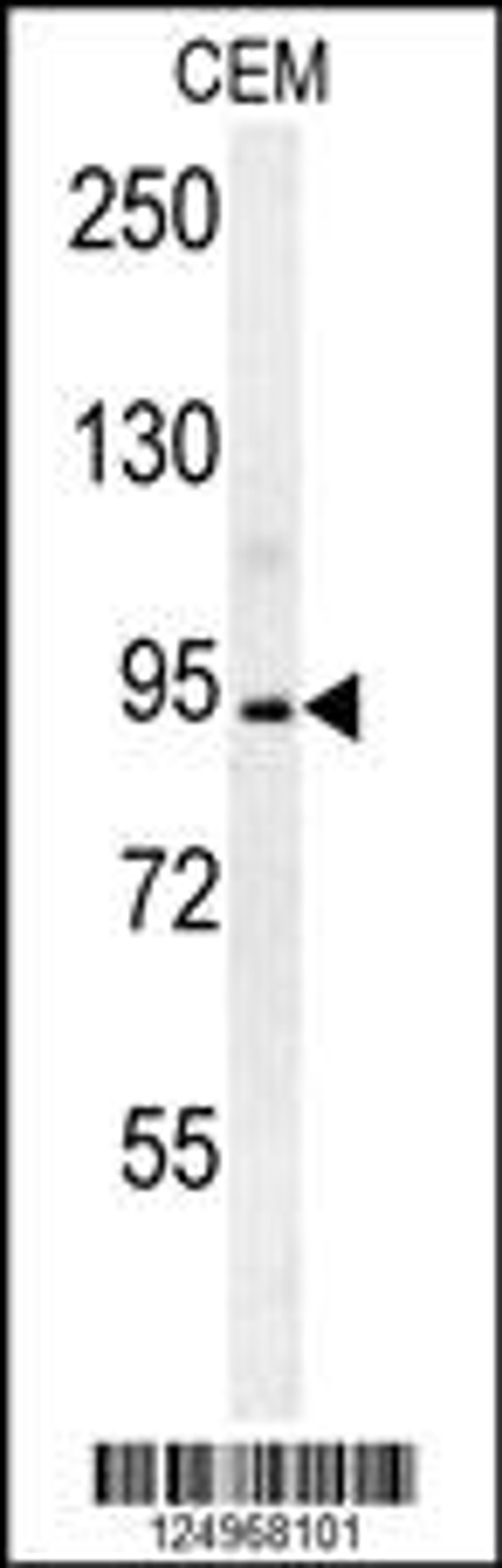 Western blot analysis in CEM cell line lysates (35ug/lane).