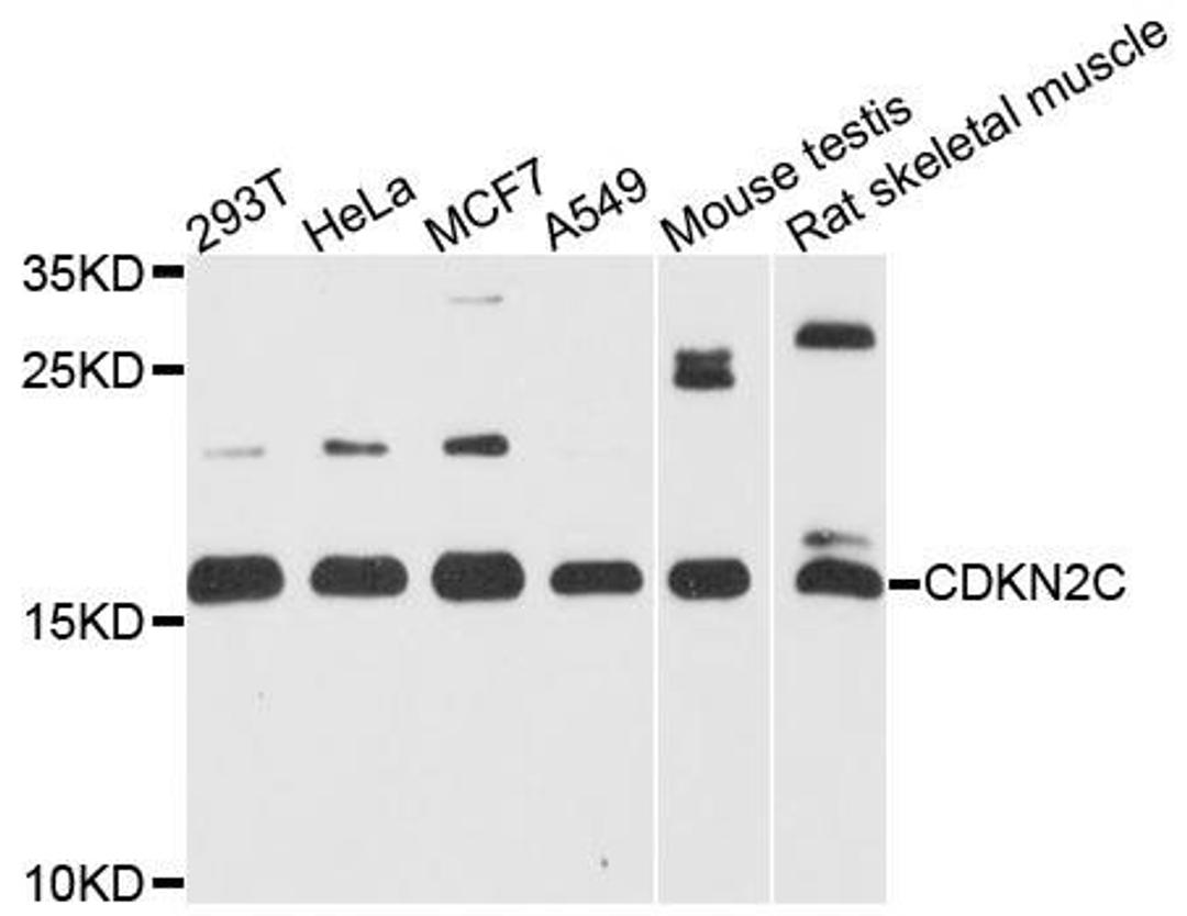 Western blot analysis of extracts of various cell lines using CDKN2C antibody