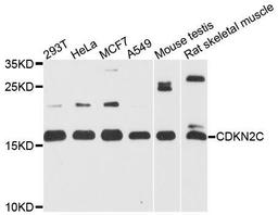 Western blot analysis of extracts of various cell lines using CDKN2C antibody