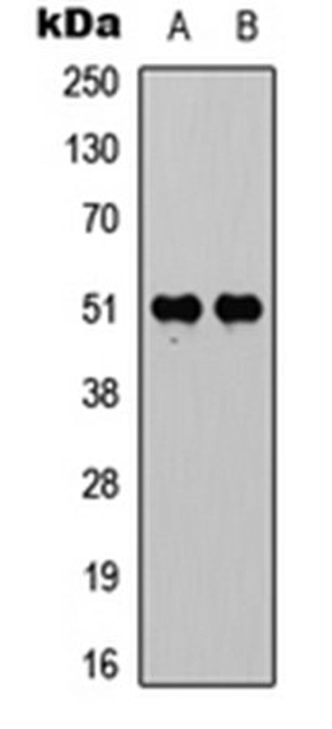 Western blot analysis of HeLa (Lane 1), HepG2 (Lane 2) whole cell lysates using VDR (phospho-S208) antibody