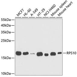 Western blot - RPS10 antibody (A5880)