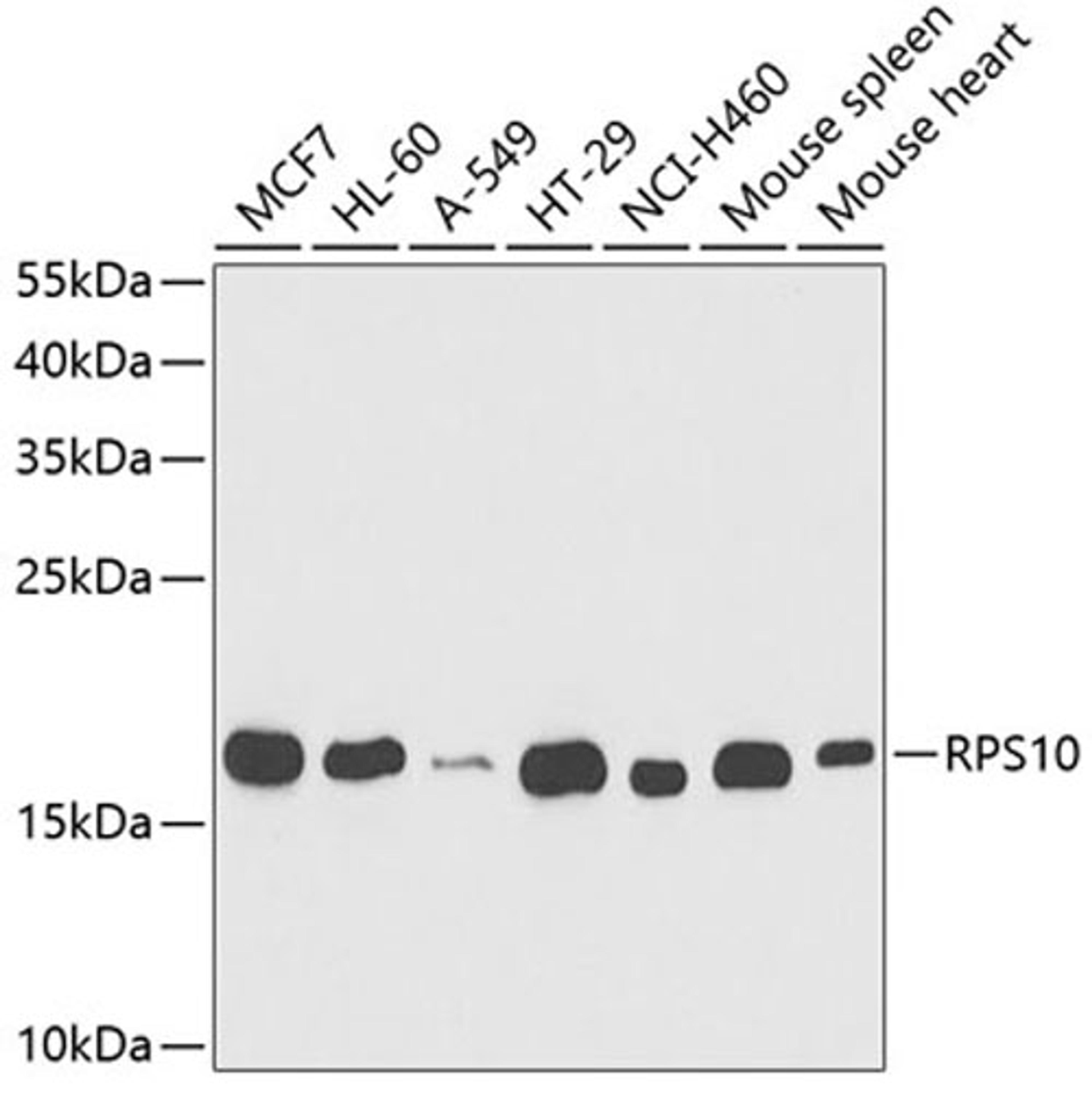 Western blot - RPS10 antibody (A5880)