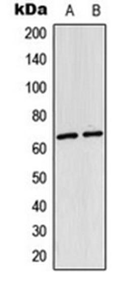 Western blot analysis of HeLa (Lane 1), mouse lung (Lane 2) whole cell lysates using NF-kappaB p65 (AcK310) antibody