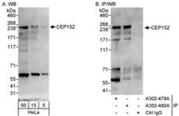 Detection of human CEP152 by western blot and immunoprecipitation.