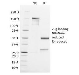 SDS-PAGE Analysis of Purified, BSA-Free TNF-alpha Antibody (clone TNF656). Confirmation of Integrity and Purity of the Antibody.