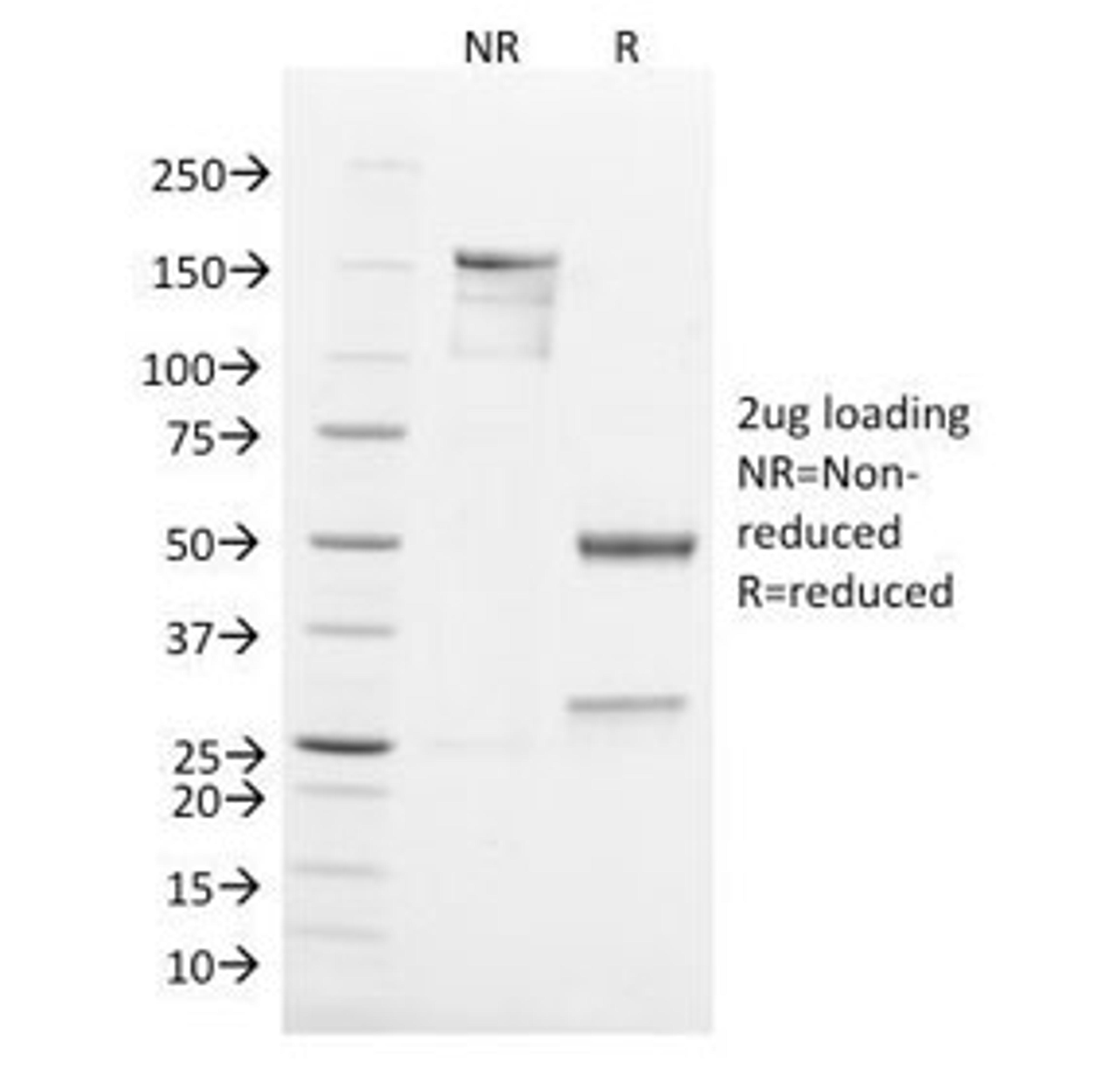 SDS-PAGE Analysis of Purified, BSA-Free TNF-alpha Antibody (clone TNF656). Confirmation of Integrity and Purity of the Antibody.