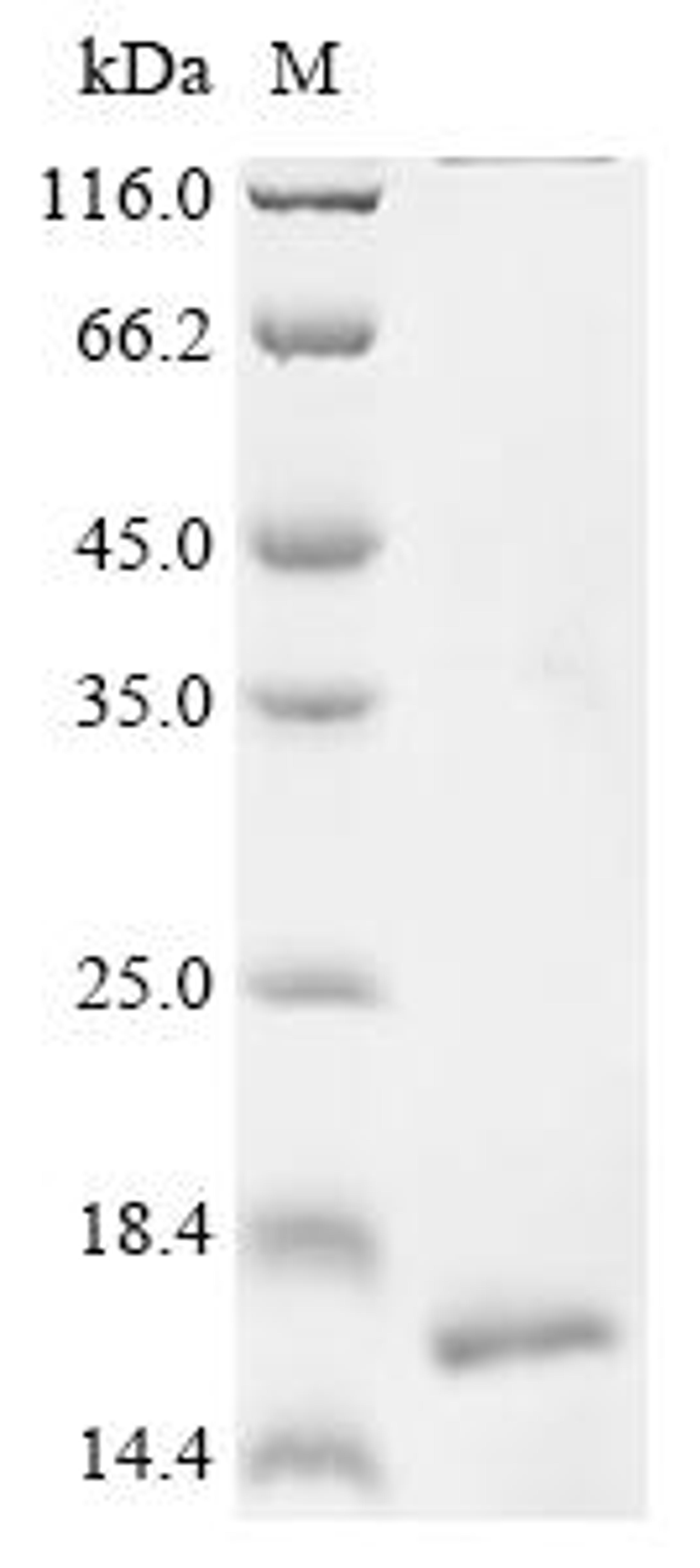 (Tris-Glycine gel) Discontinuous SDS-PAGE (reduced) with 5% enrichment gel and 15% separation gel.