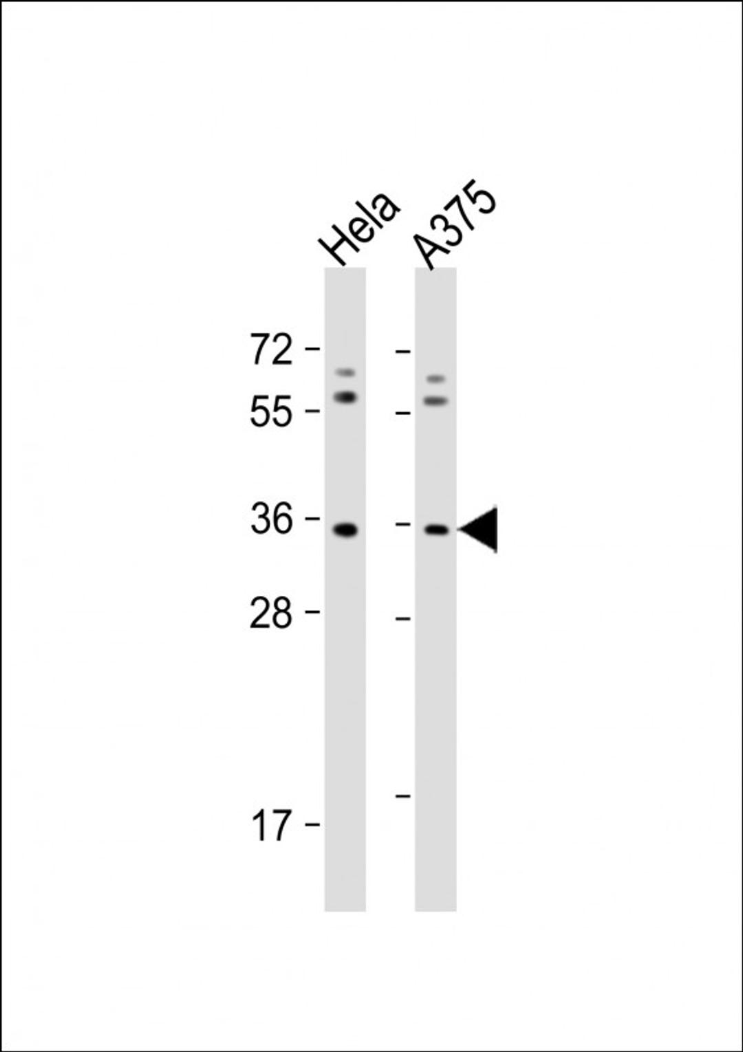 Western Blot at 1:1000 dilution Lane 1: Hela whole cell lysate Lane 2: A375 whole cell lysate Lysates/proteins at 20 ug per lane.