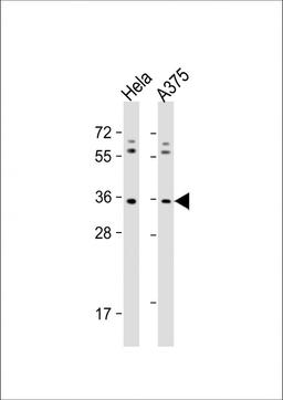 Western Blot at 1:1000 dilution Lane 1: Hela whole cell lysate Lane 2: A375 whole cell lysate Lysates/proteins at 20 ug per lane.