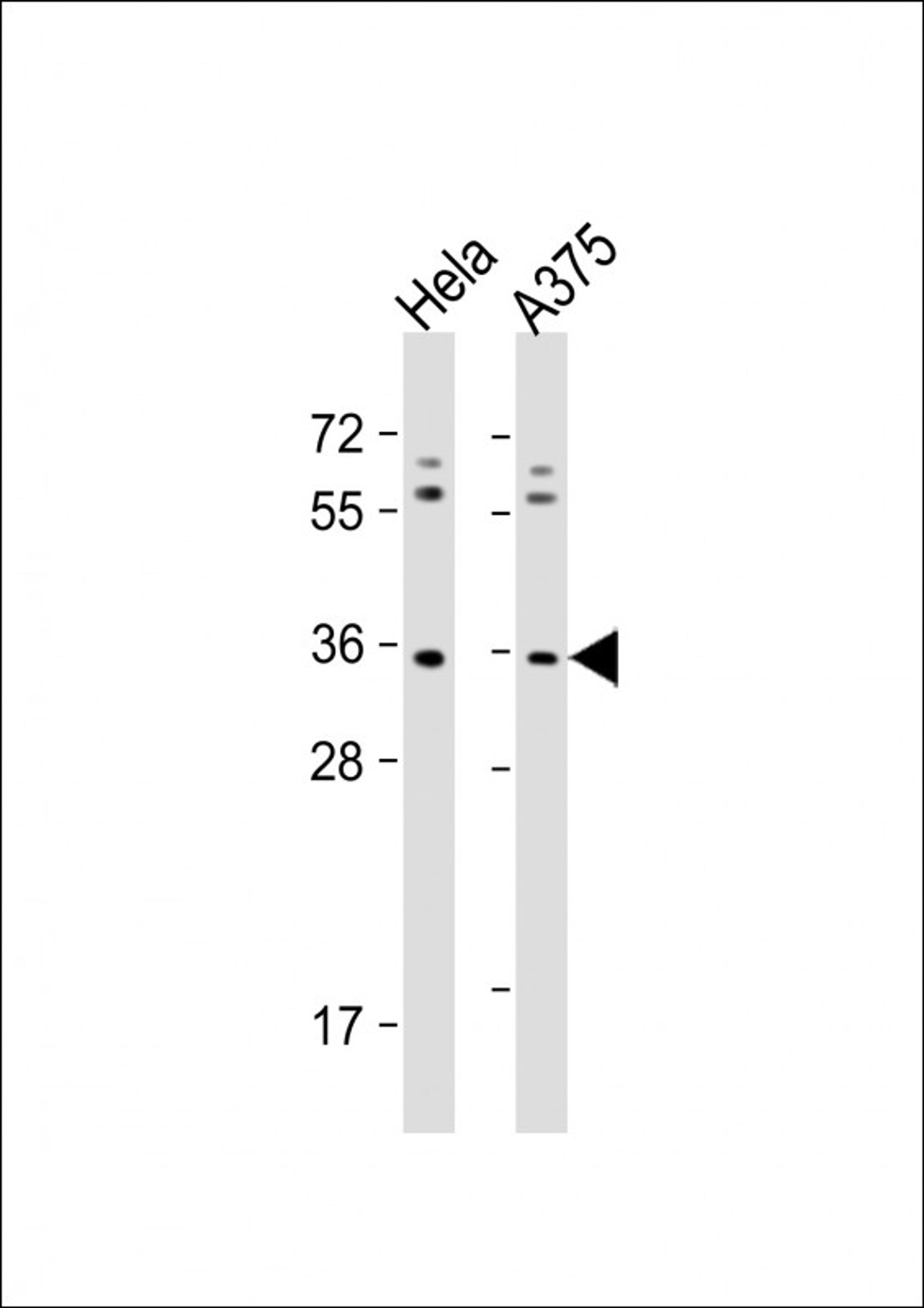 Western Blot at 1:1000 dilution Lane 1: Hela whole cell lysate Lane 2: A375 whole cell lysate Lysates/proteins at 20 ug per lane.