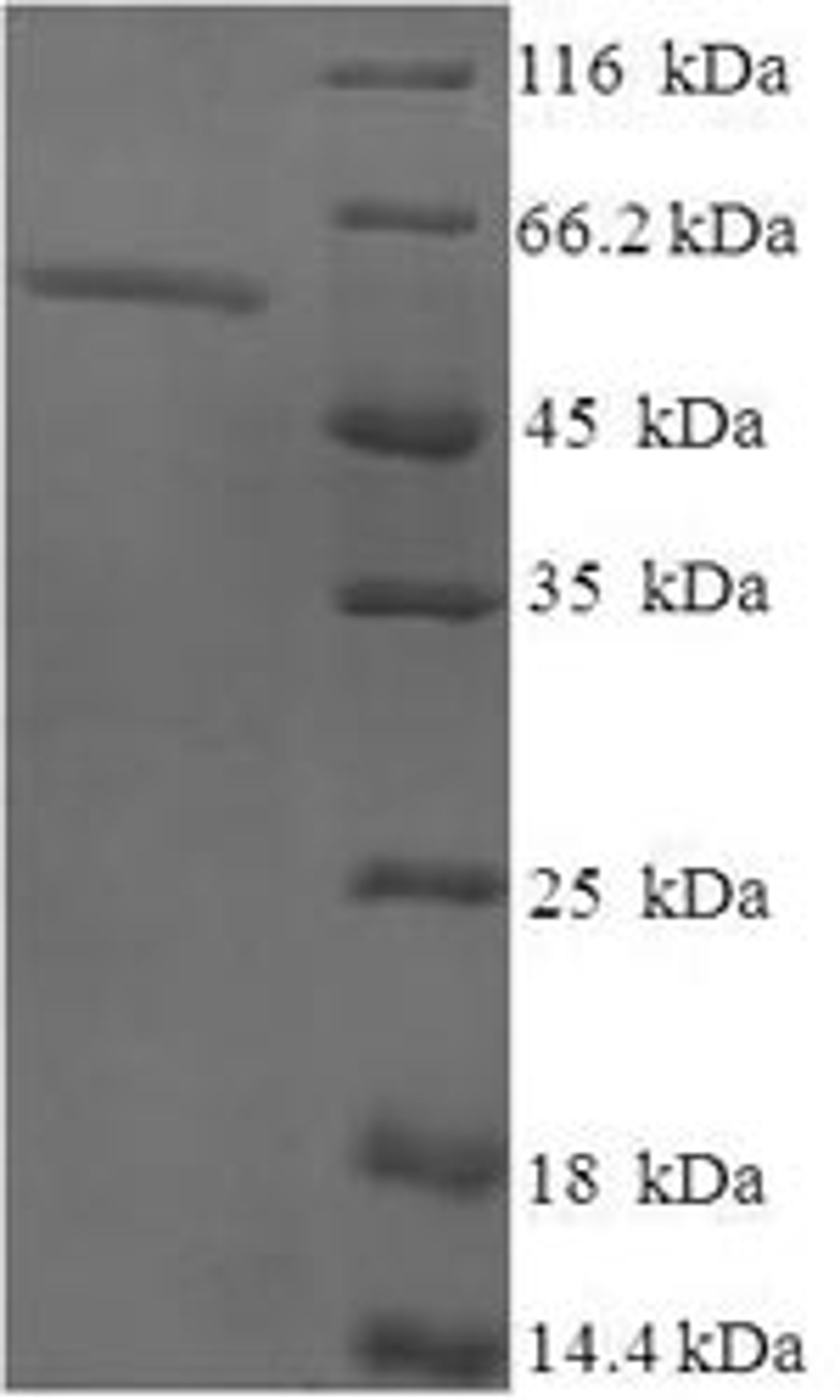 (Tris-Glycine gel) Discontinuous SDS-PAGE (reduced) with 5% enrichment gel and 15% separation gel.
