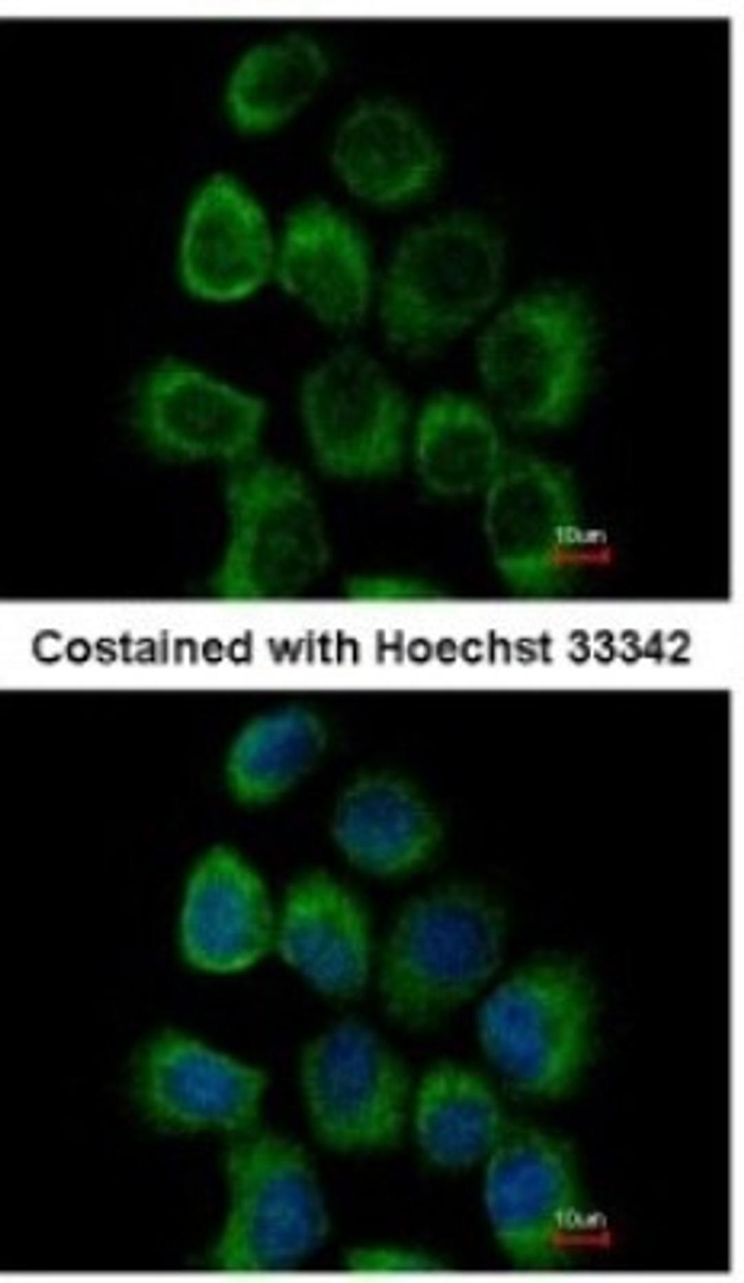 Immunocytochemistry/Immunofluorescence: Alpha Dystroglycan Antibody [NBP2-14868] - Paraformaldehyde-fixed A431, using antibody at 1:500 dilution.