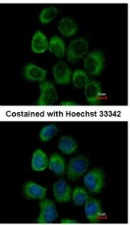 Immunocytochemistry/Immunofluorescence: Alpha Dystroglycan Antibody [NBP2-14868] - Paraformaldehyde-fixed A431, using antibody at 1:500 dilution.