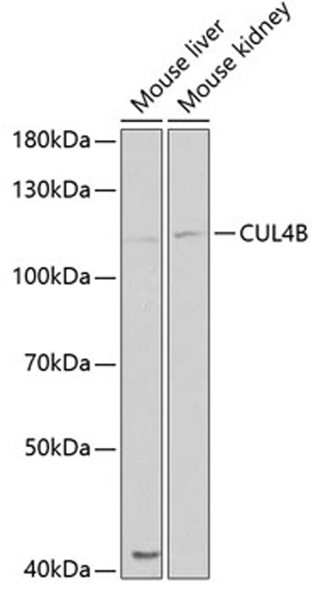 Western blot - CUL4B antibody (A5400)