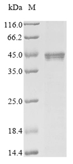 (Tris-Glycine gel) Discontinuous SDS-PAGE (reduced) with 5% enrichment gel and 15% separation gel.