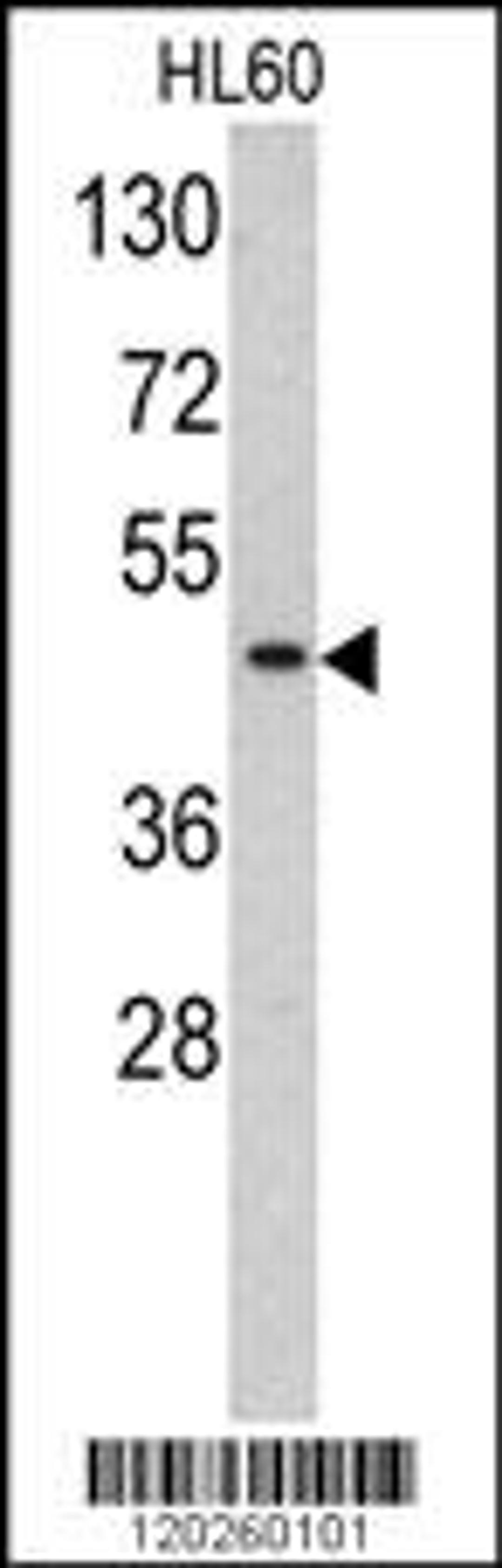 Western blot analysis of TBP antibody in HL60 cell line lysates (35ug/lane)