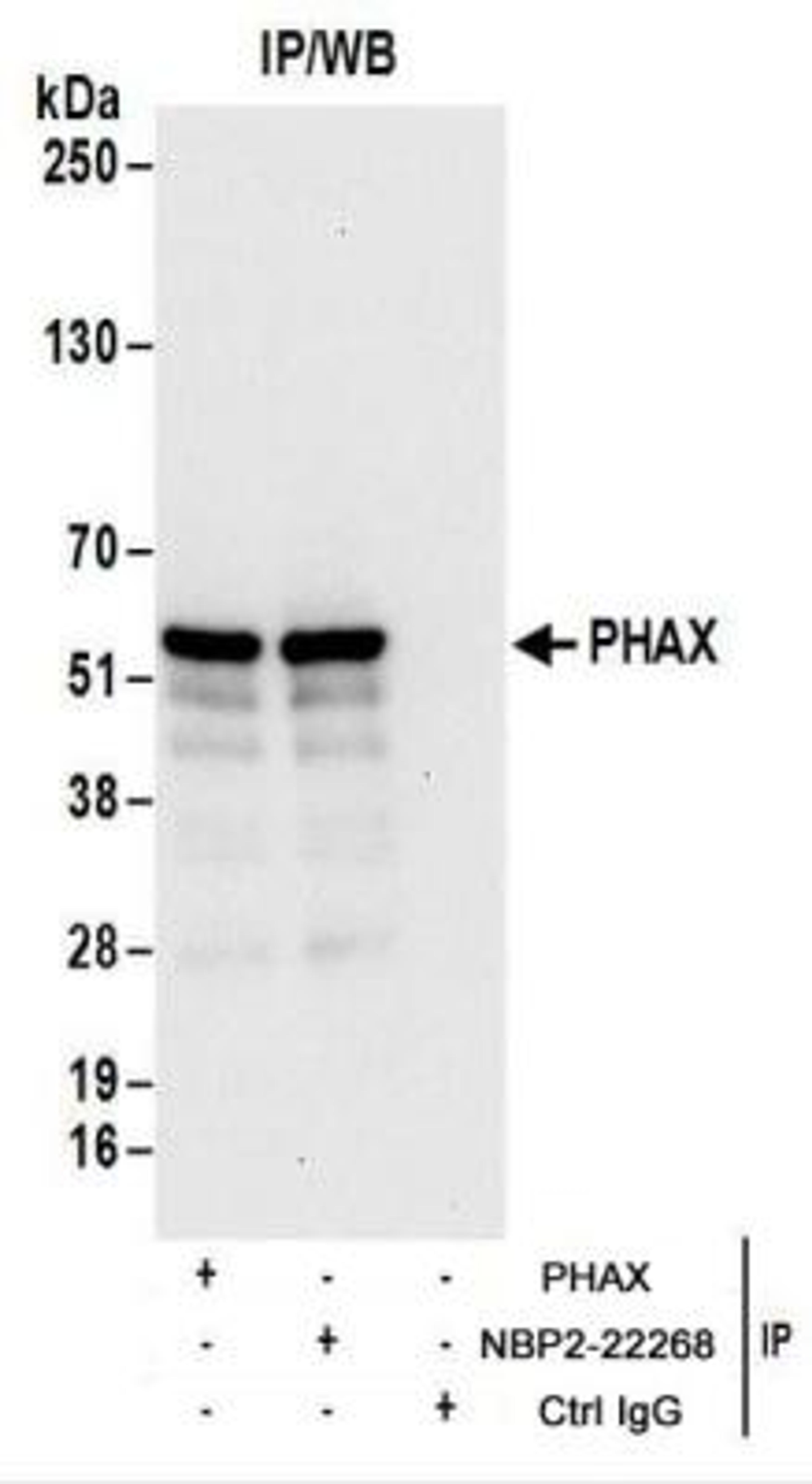 Immunoprecipitation: PHAX Antibody [NBP2-22268] - Whole cell lysate (1 mg for IP; 20% of IP loaded) from 293T cells.  Antibodies: NBP2-22268 used for IP at 6 ug/mg lysate.  PHAX was also immunoprecipitated by rabbit anti-PHAX antibody.  For blotting immunoprecipitated PHAX, NBP2-22268 was used at 0.1 ug/ml.  Detection: Chemiluminescence with an exposure time of 10 seconds.