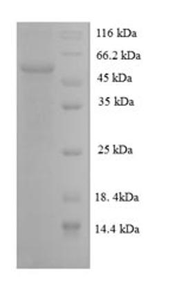 (Tris-Glycine gel) Discontinuous SDS-PAGE (reduced) with 5% enrichment gel and 15% separation gel.