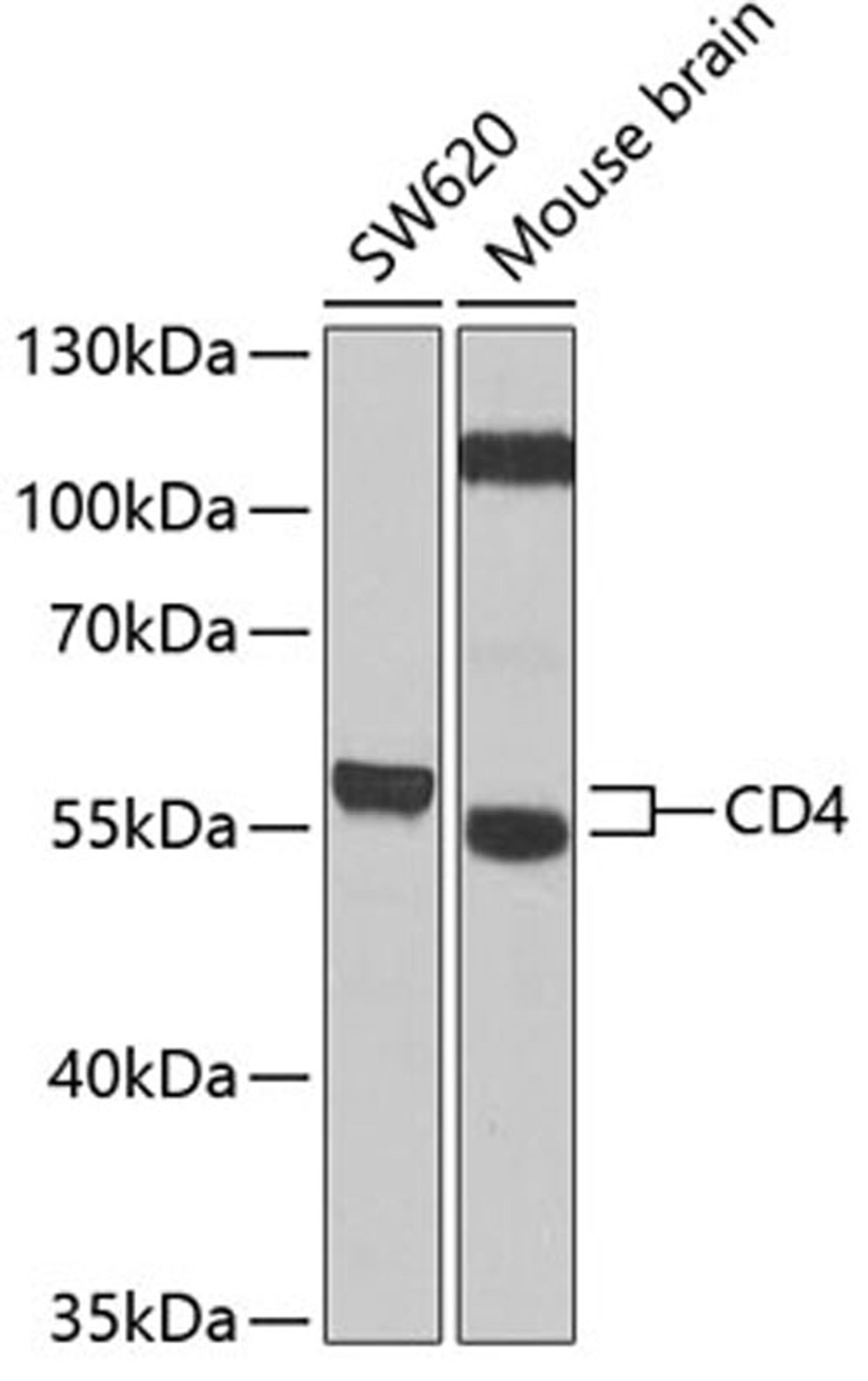 Western blot - CD4 antibody (A1549)