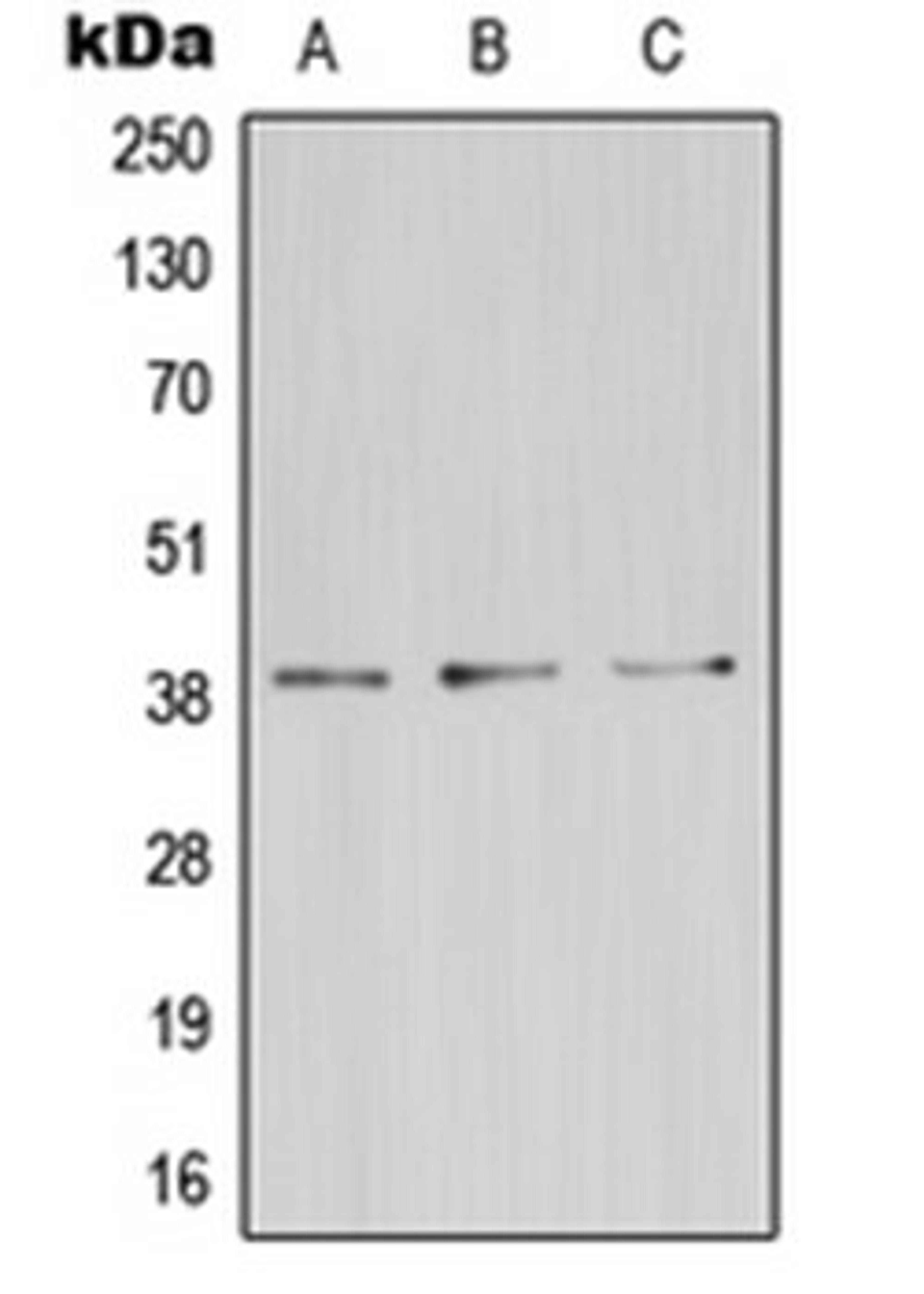 Western blot analysis of HeLa (Lane 1), mouse kidney (Lane 2), rat brain (Lane 3) whole cell lysates using ZDHHC9 antibody