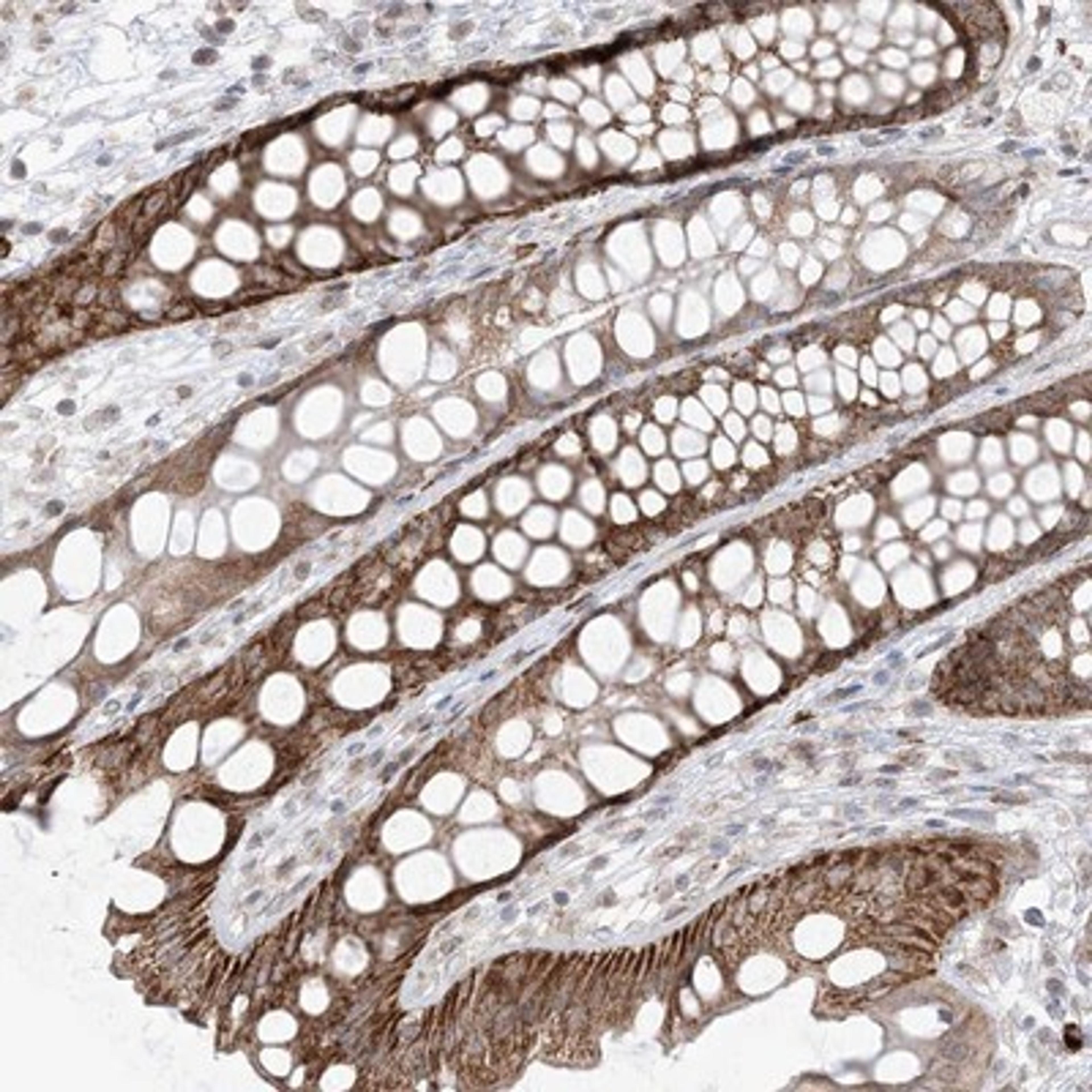 Immunohistochemistry-Paraffin: UBE2E2 Antibody [NBP1-92556] - Staining of human rectum shows strong cytoplasmic positivity in glandular cells.