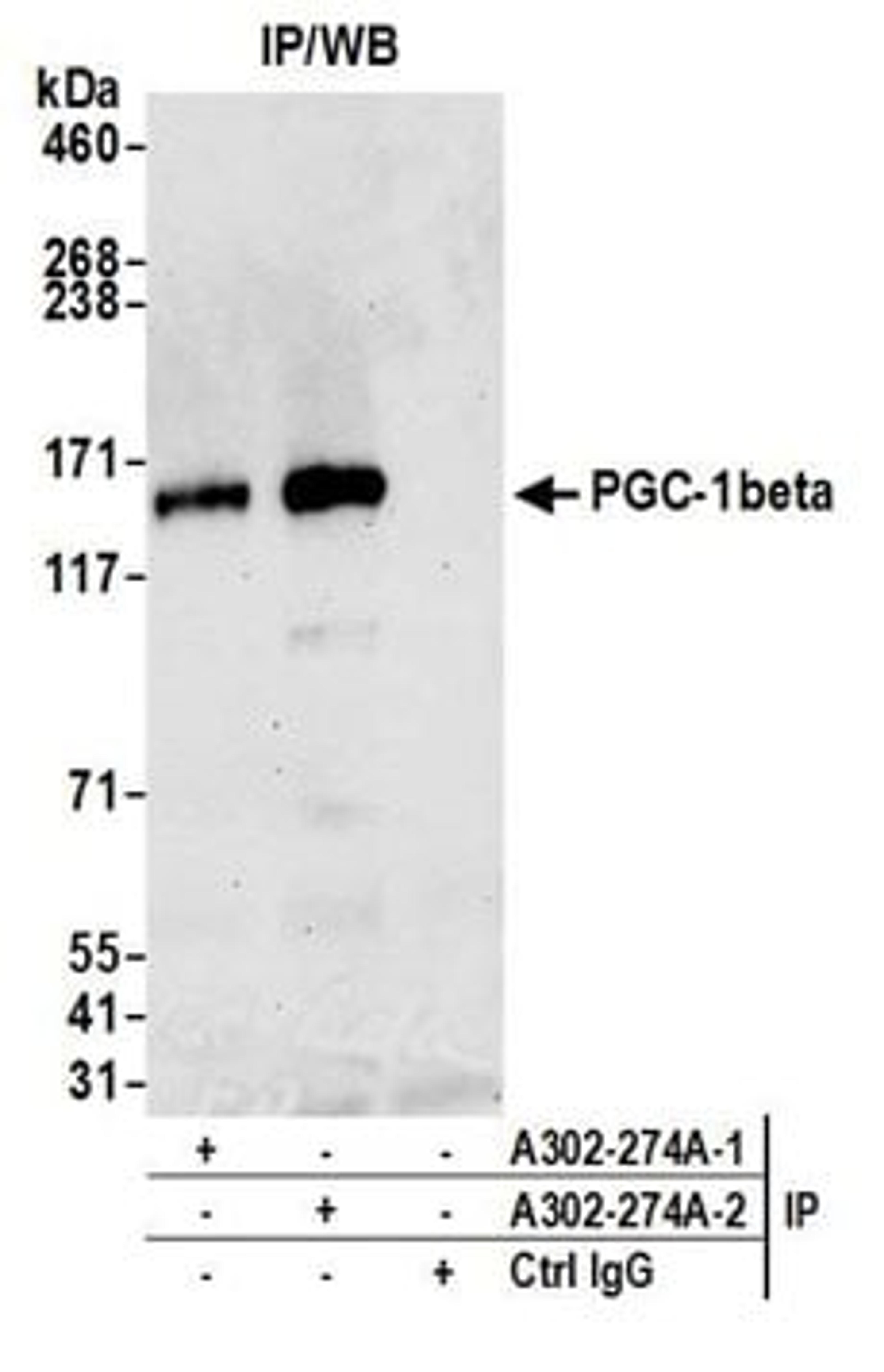 Detection of human PGC-1beta by western blot of immunoprecipitates.