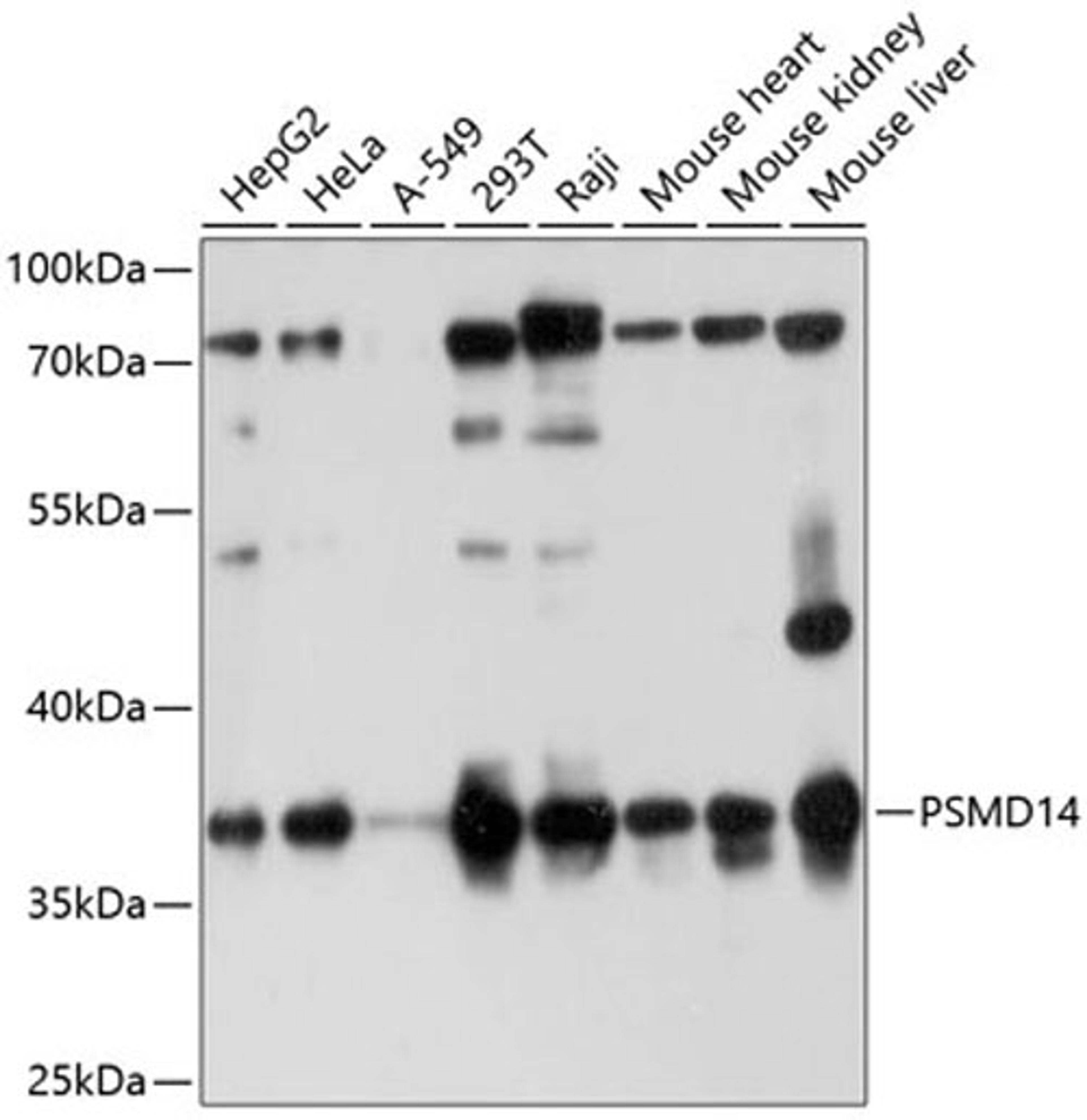 Western blot - PSMD14 antibody (A10782)